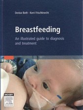 Breastfeeding: An Illustrated