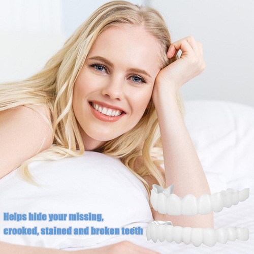 Instaveneers denti finti