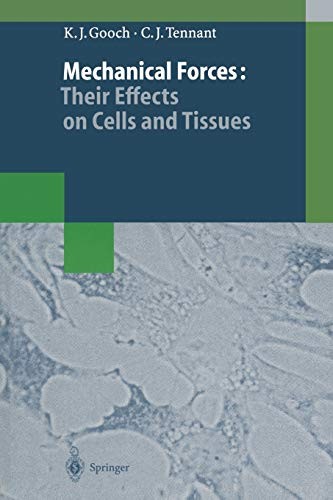 Mechanical forces their - forces:,