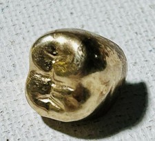 Antica Protesi Dentaria Molare