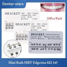 Staffe ortodontiche dentali