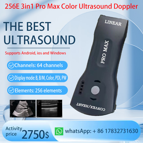 Scanner doppler ultrasuoni - scanner,