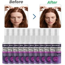 Minoxidil 2% Extra Forza