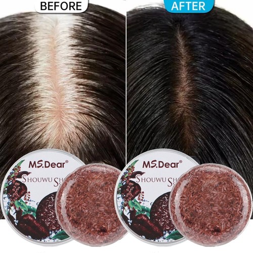 2pcs sapone biologico capelli - 2pcs,