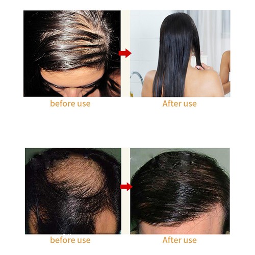 Pettine laser crescita capelli - pettine,