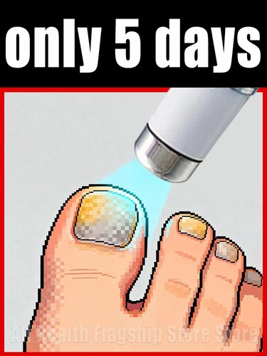 Advanced blue laser - advanced, nail