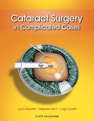 Cataract surgery - cataract, in