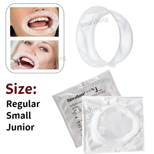 Apribocca dentale ivoclar - dentale,