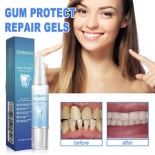 Gel Riparatore Denti 4ml per