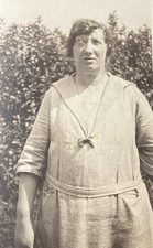 Donna con protesi in vetro