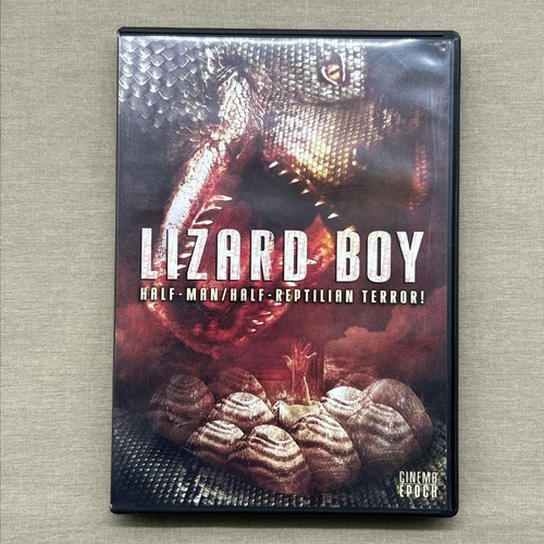 Lizard boy genetic - (dvd, 2011)