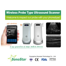 Scanner sonda ultrasuoni