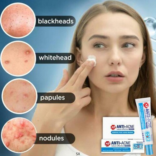 Crema anti brufoli acne contro