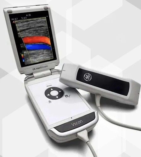 Vscan sistema ultrasuoni - sistema,