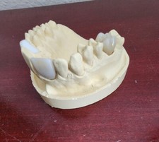 INCISAL CENTRALE SUPERIORE