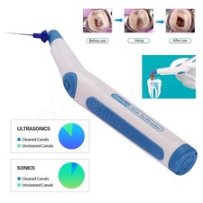 Dentista Endodonzia Endo Ultra