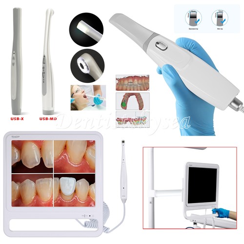 Scanner intraorale dentale - scanner,