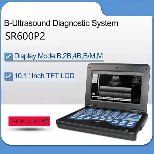 Scanner ultrasuoni - scanner,