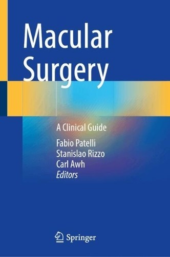 Macular surgery fabio - macular,