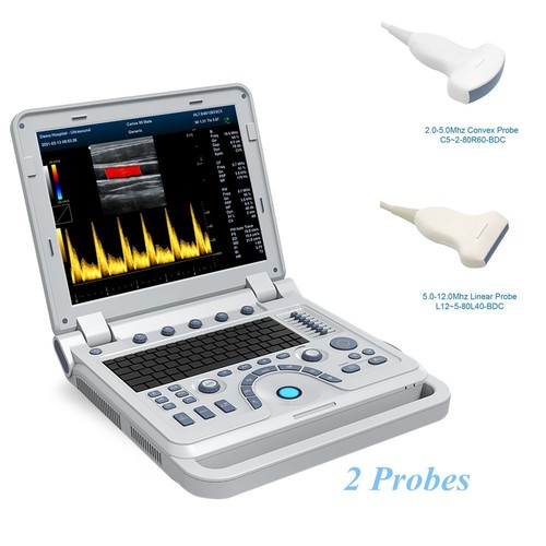 Macchina scanner ultrasuoni