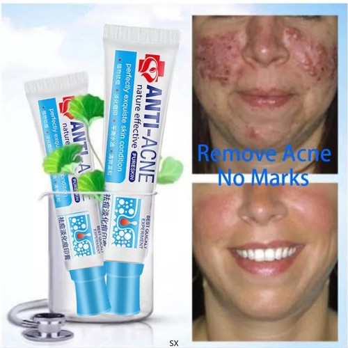 Crema acne anti brufoli