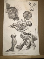 Stampo antico 1834 anatomia
