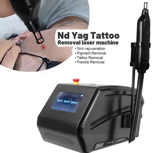 Picosecond yag rimozione - nd,