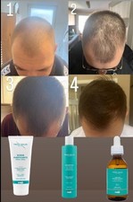 KIT ANTICADUTA: SCRUB, SHAMPOO, LOZIONE O KIT - SNEP