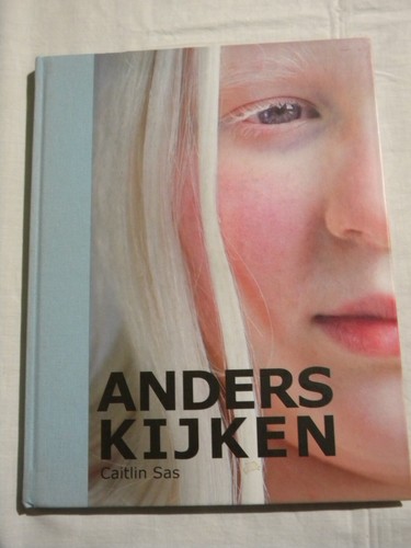 Anders kijken albinisme ltd - kijken,, albinisme,