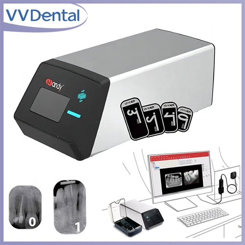 Scanner dentale digitalizzato