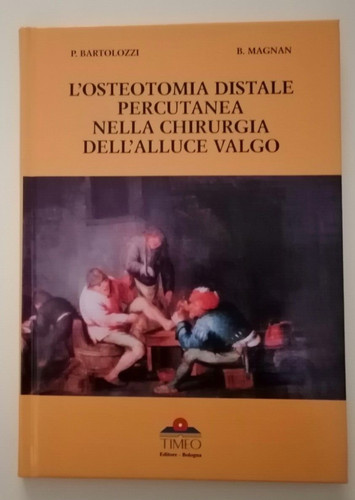Osteotomia distale - l'osteotomia,