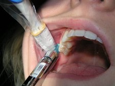 Vibrasthetic-Aiuto per