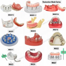 Impianto Dentale Overdenture