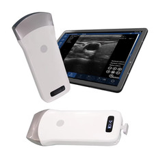Scanner sonda ultrasuoni