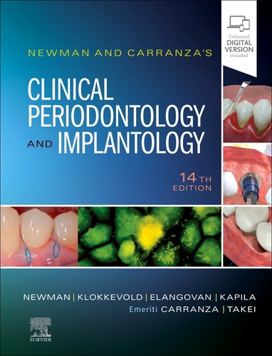 Newman and carranza clinical - newman, carranza's
