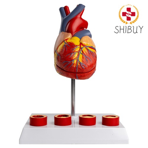 Cuore con trombo - cuore,