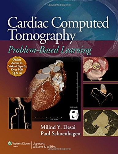 Cardiac computed tomography - cardiac,