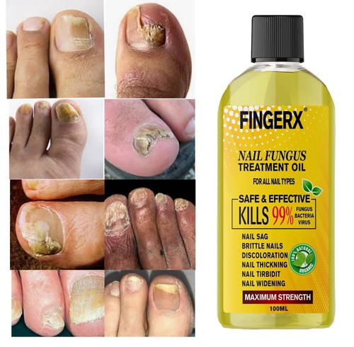 100ml trattamento anti funghi - trattamento,