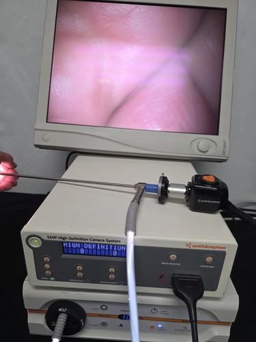 Smith nephew 560p sistema di - nephew,