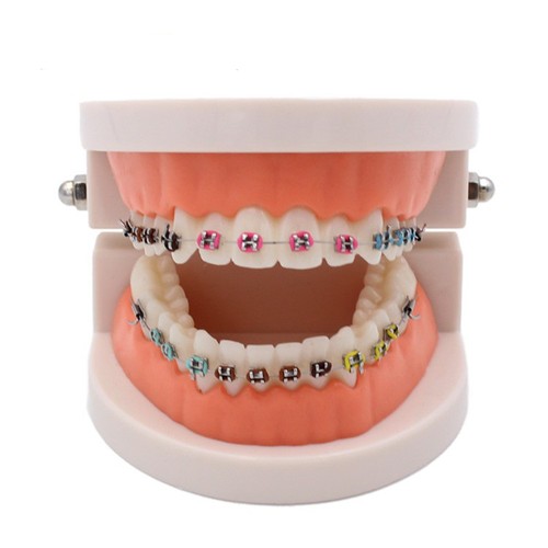 Modello denti con - modello, di