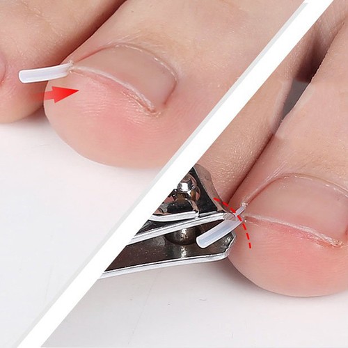 Pezzi clip raddrizzamento - pezzi,