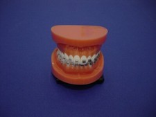 Modello dentale ortodontico