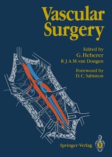 Vascular surgery - surgery,