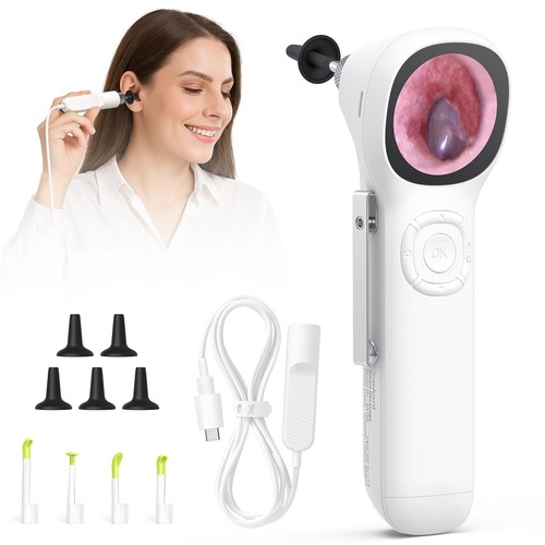Scopearound otoscopio con - otoscopio,