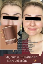 collagène Radiance éclaircissant Simon Ourian fini le cortisol, Anti Stress