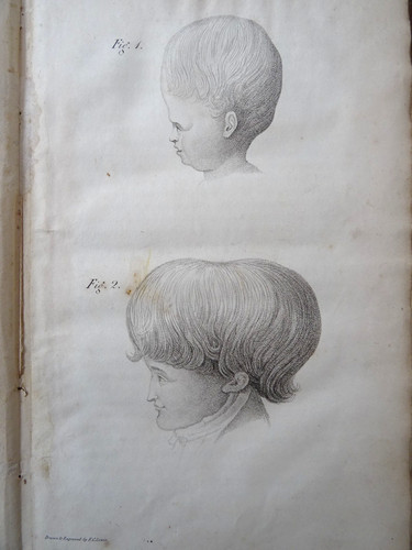 1825 phrenology doctrine - doctrine, of