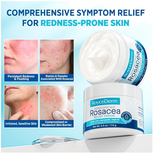 Trattamento per rosacea - , con