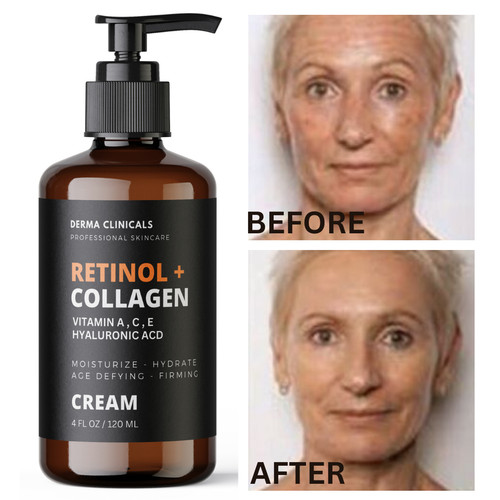 Crema siero antirughe - , retinolo
