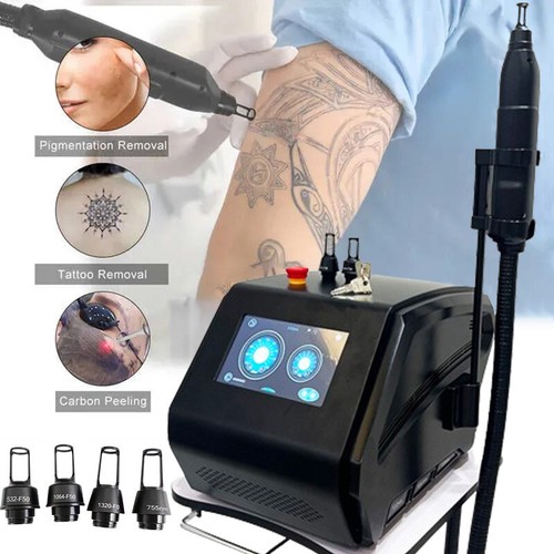 Macchina rimozione tatuaggi