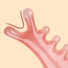 Raschietto Massaggio Resina